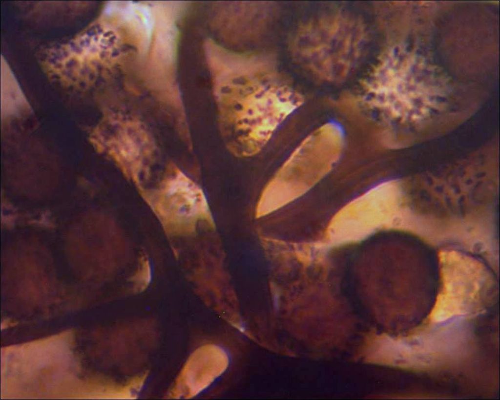 Meriderma sp